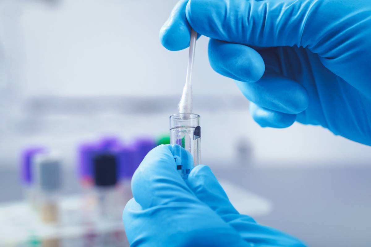 Gros plan sur colonne chromatographique HPLC avec échantillons de CBD pour analyse des cannabinoïdes